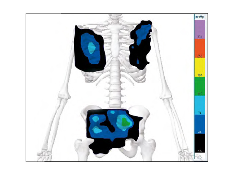 Silla basculante JUDITTA.