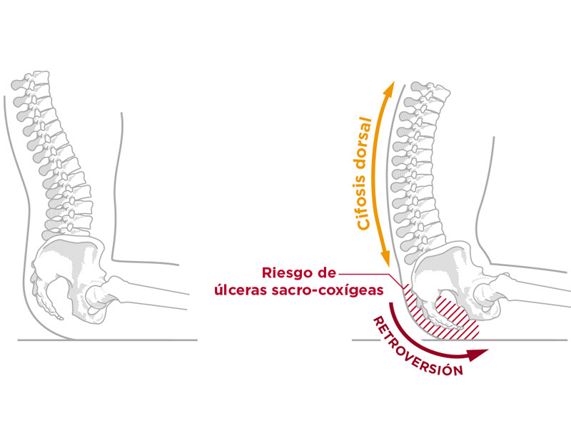 Cojín anatómico VISCOFLEX con abductor